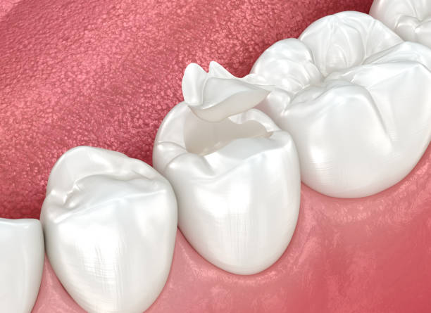 Best Wisdom Tooth Removal  in Big Bend, WI