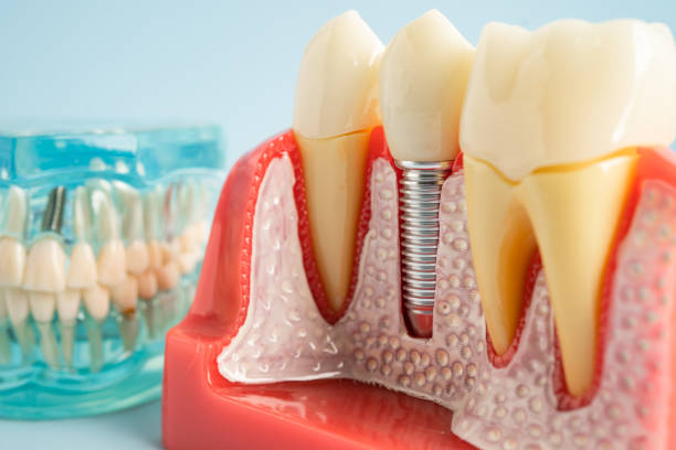 Best Dental Exams and Cleanings  in Big Bend, WI